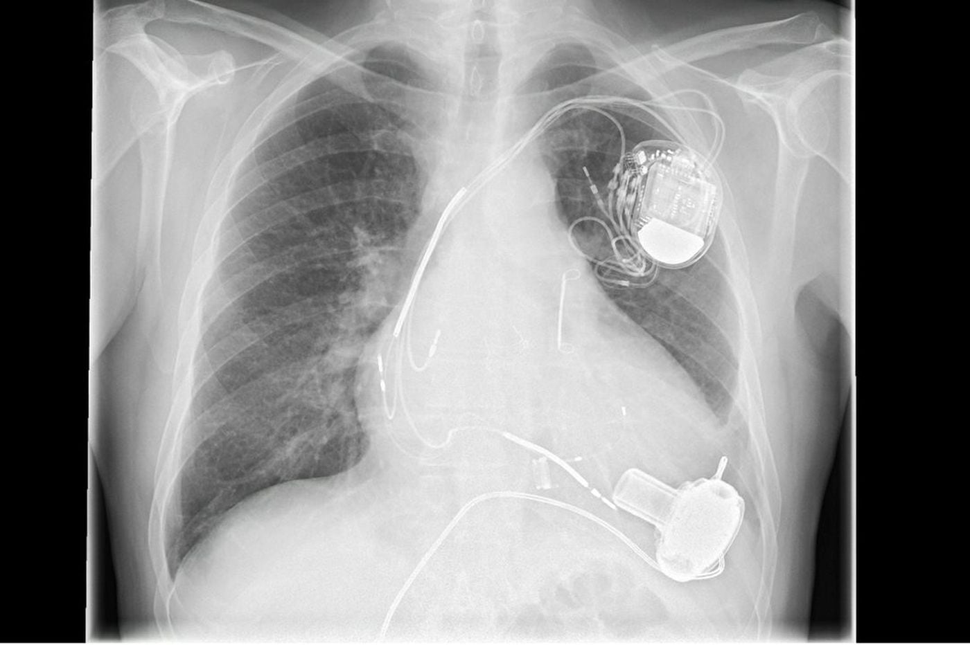 medical-mystery-what-caused-chest-pain-shortness-of-breath-in-older-man