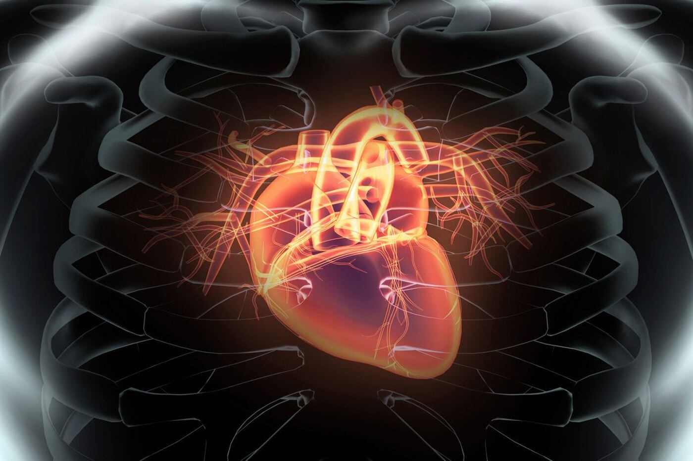 q-a-what-is-cardiogenic-shock-and-why-should-i-care