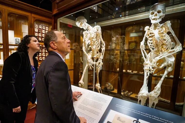 New Mutter Museum exhibit grants final wish for woman who turned to bone