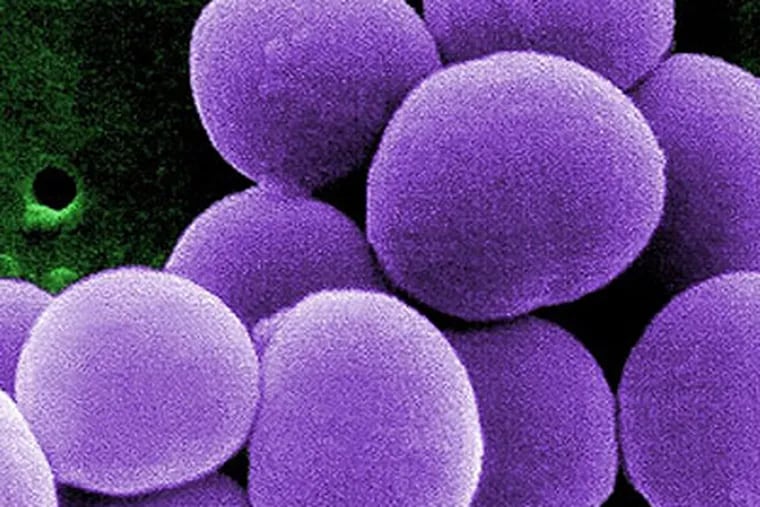 Methicillin-resistant Staphylococcus aureus - Wikipedia