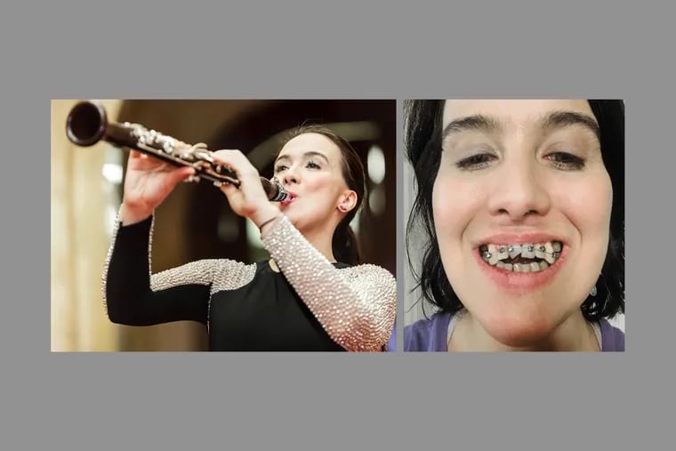 Boja Kragulj, an accomplished clarinetist, says she used the AGGA (Anterior Growth Guidance Appliance) in hopes of correcting her misaligned bite and improving her breathing without surgery. Kragulj has alleged in an ongoing lawsuit that the unproven and unregulated device caused catastrophic harm to her teeth. AGGA inventor Dr. Steve Galella and his company have denied all liability.