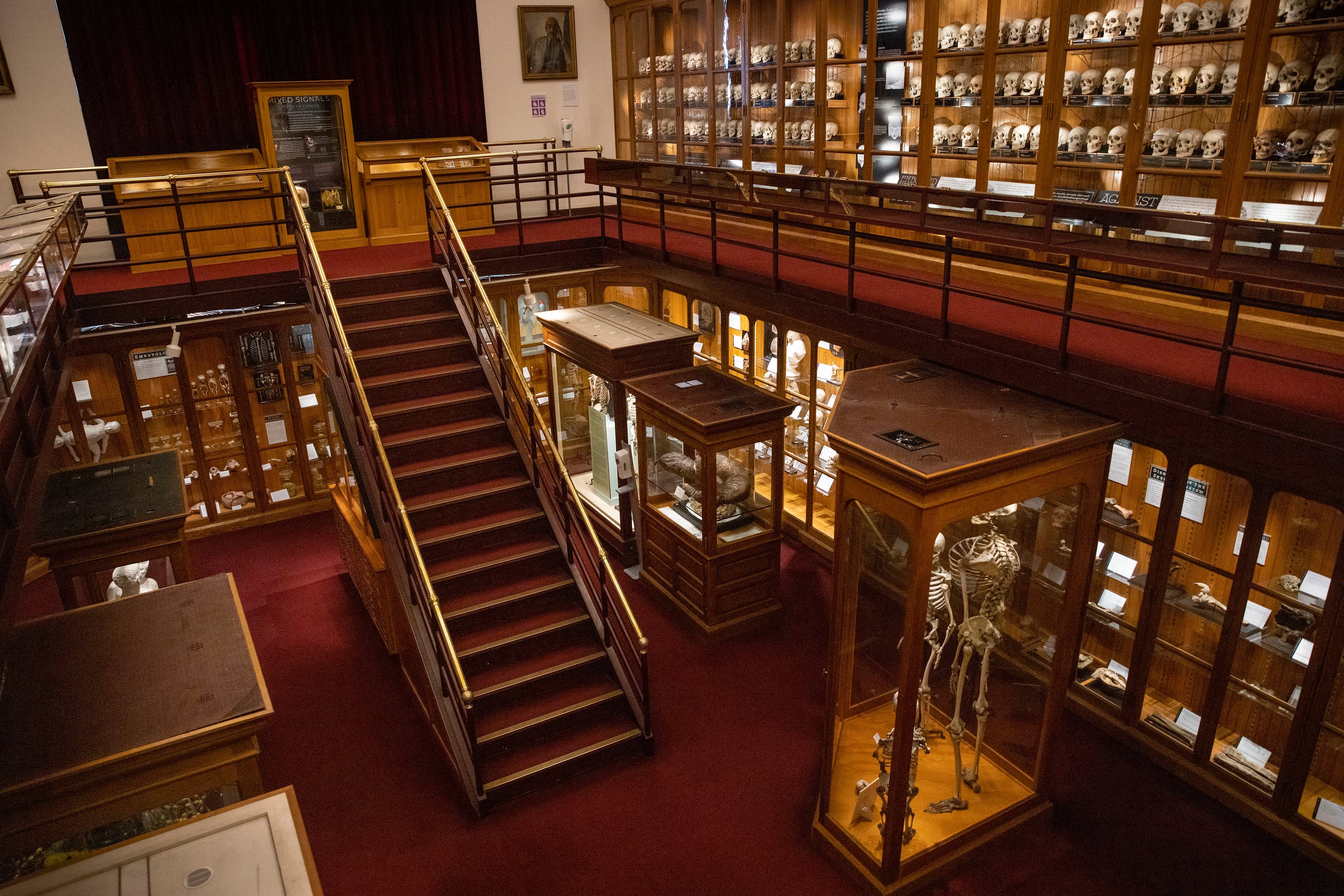 Mütter Museum donated display cases to a Philly resale shop