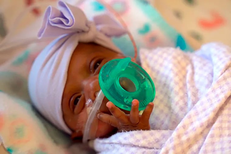 This March, 2019 photo provided by Sharp HealthCare in San Diego shows a baby named Saybie. Sharp Mary Birch Hospital for Women & Newborns said in a statement Wednesday, May 29, 2019, that Saybie, born at 23 weeks and three days, is believed to be the world's tiniest surviving baby, who weighed just 245 grams (about 8.6 ounces) before she was discharged as a healthy infant. She was sent home this month weighing 5 pounds (2 kilograms) after nearly five months in the hospital's neonatal intensive care unit. (Sharp HealthCare via AP)