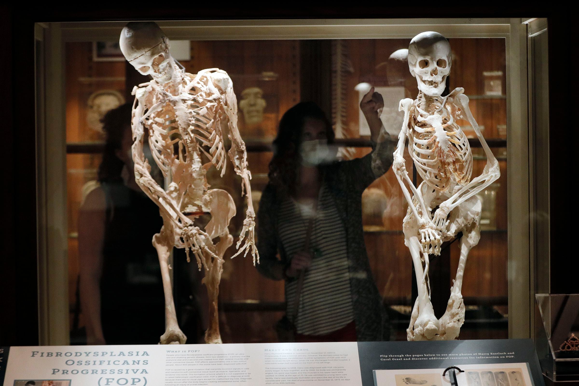 A sanitized Mütter Museum would be a disgrace to medical science