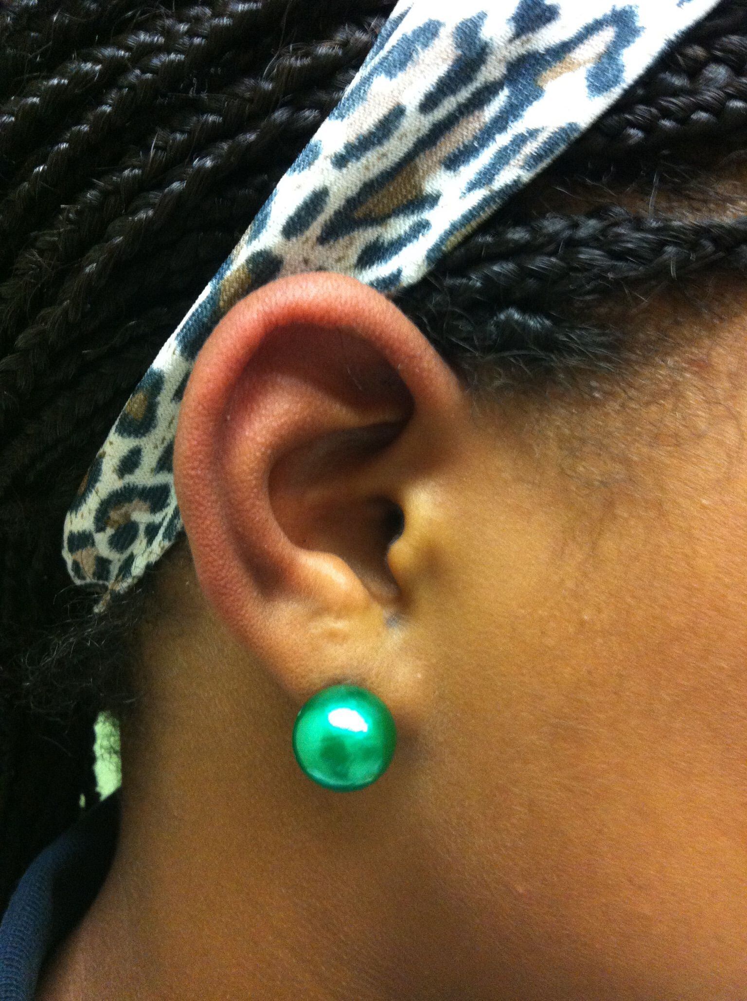 Medical mystery: A teen's ear piercing goes awry